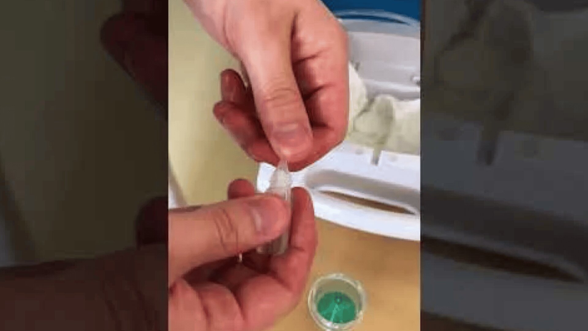 Nahaufnahme von Händen, die einen kleinen Plastikbehälter öffnen, möglicherweise für einen medizinischen oder wissenschaftlichen Zweck, wobei im Hintergrund eine grüne Substanz und ein weißes Tablett zu sehen sind.